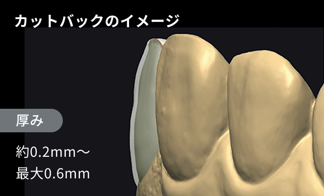 image：カットバックのイメージ